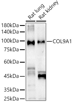 Western Blot: COL9A1 Antibody - BSA Free [NBP2-92796] - Western blot analysis of extracts of various cell lines, using COL9A1 Rabbit pAb antibody  at 1:1000 dilution.&lt;br&gt;Secondary antibody: HRP Goat Anti-Rabbit IgG (H+L)  at 1:10000 dilution.&lt;br&gt;Lysates/proteins: 25ug per lane.&lt;br&gt;Blocking buffer: 3% nonfat dry milk in TBST.&lt;br&gt;Detection: ECL Basic Kit.&lt;br&gt;Exposure time: 90s.