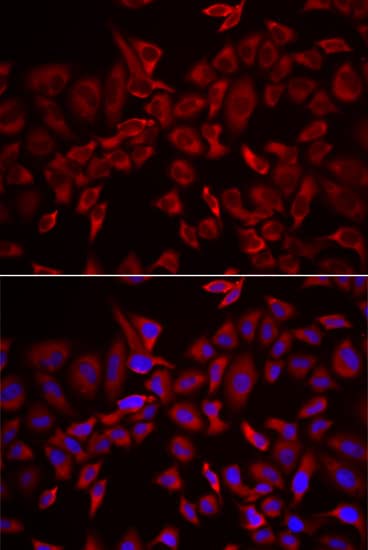 Immunocytochemistry/ Immunofluorescence: CSRP3 Antibody - BSA Free [NBP2-92797] - Immunofluorescence analysis of HeLa cells using CSRP3 Rabbit pAb . Secondary antibody: Cy3-conjugated Goat anti-Rabbit IgG (H+L)  at 1:500 dilution. Blue: DAPI for nuclear staining.