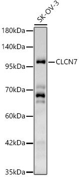 Western Blot CLCN7 Antibody - BSA Free