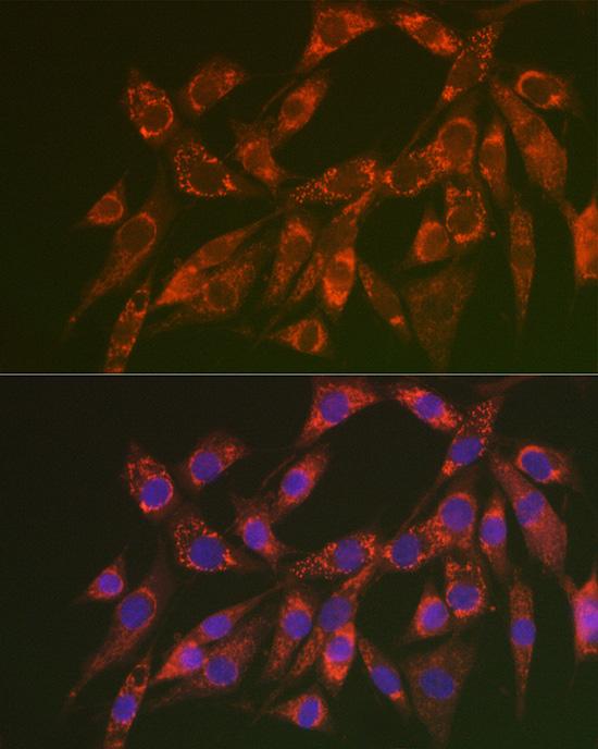 Immunocytochemistry/ Immunofluorescence: CHMP4B Antibody - BSA Free [NBP2-92805] - Immunofluorescence analysis of NIH/3T3 cells using CHMP4B Rabbit pAb  at dilution of 1:200 (40x lens). Secondary antibody: Cy3 Goat Anti-Rabbit IgG (H+L)  at 1:500 dilution. Blue: DAPI for nuclear staining.