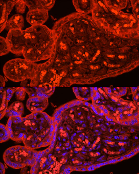 Immunocytochemistry/ Immunofluorescence: ATG9B Antibody - Azide and BSA Free [NBP2-92806] - Immunofluorescence analysis of human placenta cells using ATG9B Rabbit pAb  at dilution of 1:50 (40x lens). Blue: DAPI for nuclear staining.