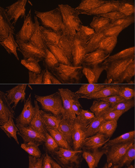 Immunocytochemistry/ Immunofluorescence: DAAM2 Antibody - BSA Free [NBP2-92809] - Immunofluorescence analysis of H9C2 cells using DAAM2 Rabbit pAb  at dilution of 1:100. Secondary antibody: Cy3 Goat Anti-Rabbit IgG (H+L)  at 1:500 dilution. Blue: DAPI for nuclear staining.