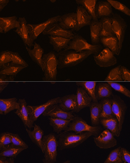 Immunocytochemistry/ Immunofluorescence: DAAM2 Antibody - BSA Free [NBP2-92809] - Immunofluorescence analysis of U2OS cells using DAAM2 Rabbit pAb  at dilution of 1:100. Secondary antibody: Cy3 Goat Anti-Rabbit IgG (H+L)  at 1:500 dilution. Blue: DAPI for nuclear staining.
