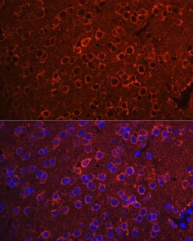 Immunocytochemistry/ Immunofluorescence: 14-3-3 zeta/delta Antibody - Azide and BSA Free [NBP2-92813] - Immunofluorescence analysis of paraffin-embedded Rat brain using 14-3-3 zeta/delta Rabbit pAb  at dilution of 1:100. Secondary antibody: Cy3-conjugated Goat anti-Rabbit IgG (H+L)  at 1:500 dilution. Blue: DAPI for nuclear staining.