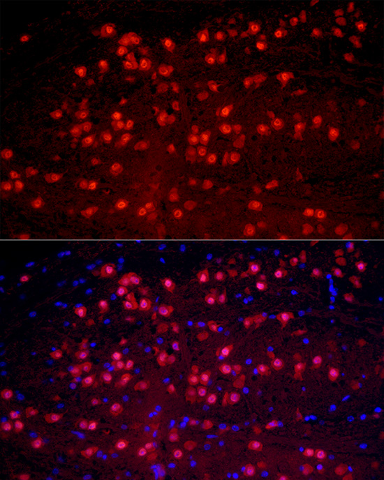 Immunocytochemistry/ Immunofluorescence: A2BP1 Antibody - Azide and BSA Free [NBP2-92816] - Immunofluorescence analysis of mouse brain cells using A2BP1 Rabbit pAb  at dilution of 1:50 (40x lens). Blue: DAPI for nuclear staining.