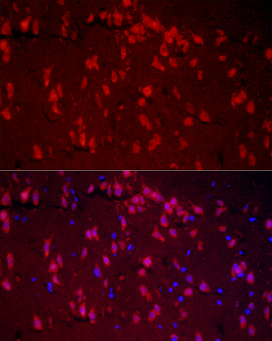 Immunocytochemistry/ Immunofluorescence: A2BP1 Antibody - Azide and BSA Free [NBP2-92816] - Immunofluorescence analysis of rat brain cells using A2BP1 Rabbit pAb  at dilution of 1:50 (40x lens). Blue: DAPI for nuclear staining.