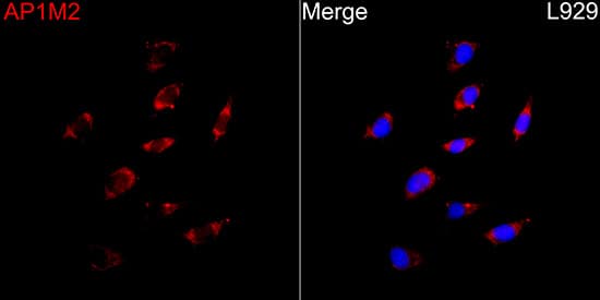 Immunocytochemistry/ Immunofluorescence AP1M2 Antibody - BSA Free