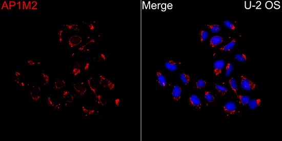 Immunocytochemistry/ Immunofluorescence AP1M2 Antibody - BSA Free