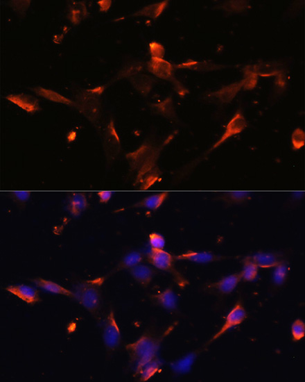 Immunocytochemistry/ Immunofluorescence: Claudin-5 Antibody - Azide and BSA Free [NBP2-92846] - Immunofluorescence analysis of NIH/3T3 cells using Claudin-5 Rabbit pAb  at dilution of 1:100. Secondary antibody: Cy3 Goat Anti-Rabbit IgG (H+L)  at 1:500 dilution. Blue: DAPI for nuclear staining.