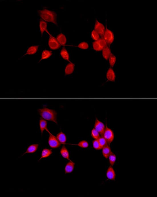 Immunocytochemistry/ Immunofluorescence: AMBRA1 Antibody - BSA Free [NBP2-92849] - Immunofluorescence analysis of NIH/3T3 cells using AMBRA1 Rabbit pAb  at dilution of 1:50 (40x lens). Secondary antibody: Cy3 Goat Anti-Rabbit IgG (H+L)  at 1:500 dilution. Blue: DAPI for nuclear staining.