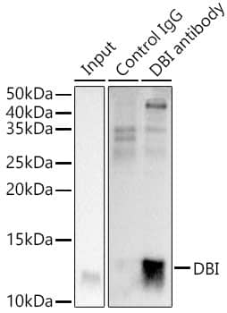 Immunoprecipitation: ACBP Antibody - Azide and BSA Free [NBP2-92856] - Immunoprecipitation analysis of 300 ug extracts of HeLa cells using 3 ug ACBP antibody . Western blot was performed from the immunoprecipitate using ACBP antibody  at a dilution of 1:1000.