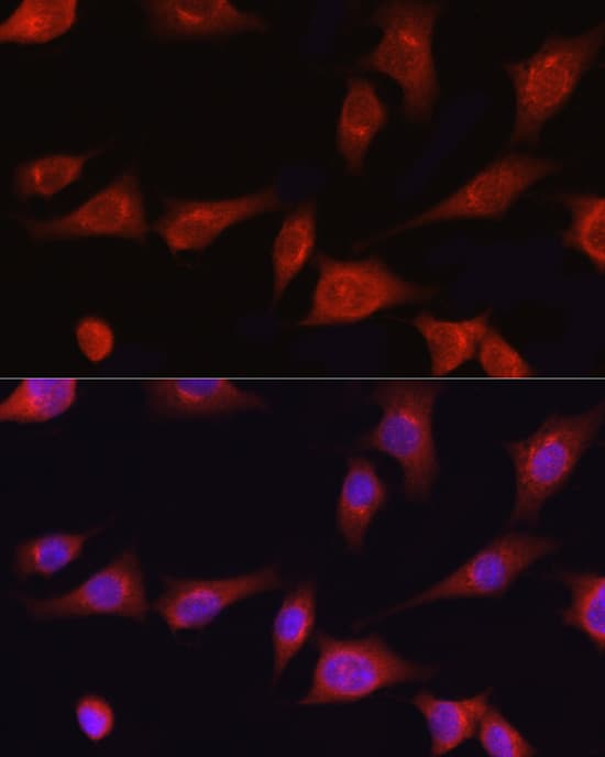 Immunocytochemistry/ Immunofluorescence: Collagen I alpha 1 Antibody - Azide and BSA Free [NBP2-92858] - Immunofluorescence analysis of NIH/3T3 cells using Collagen I alpha 1 Rabbit pAb  at dilution of 1:50 (40x lens). Secondary antibody: Cy3-conjugated Goat anti-Rabbit IgG (H+L)  at 1:500 dilution. Blue: DAPI for nuclear staining.