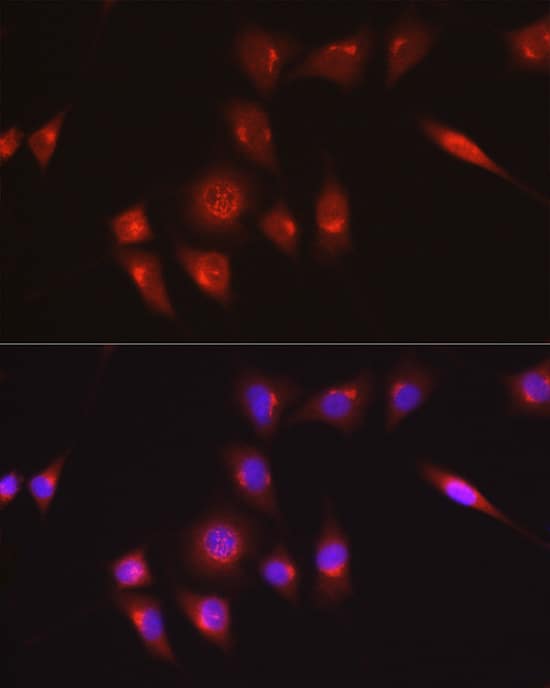 Immunocytochemistry/ Immunofluorescence: Collagen I alpha 1 Antibody - Azide and BSA Free [NBP2-92858] - Immunofluorescence analysis of NIH/3T3 cells using Collagen I alpha 1 Rabbit pAb  at dilution of 1:100 (40x lens). Secondary antibody: Cy3-conjugated Goat anti-Rabbit IgG (H+L)  at 1:500 dilution. Blue: DAPI for nuclear staining.