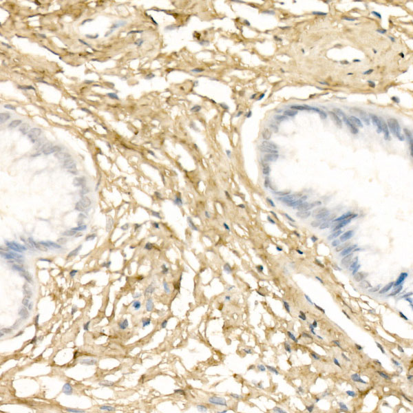 Immunohistochemistry: Collagen I alpha 1 Antibody - Azide and BSA Free [NBP2-92858] - Immunohistochemistry analysis of paraffin-embedded Human cervix tissue using Collagen I alpha 1 Rabbit pAb  at a dilution of 1:200 (40x lens). High pressure antigen retrieval was performed with 0.01 M citrate buffer (pH 6.0) prior to IHC staining.