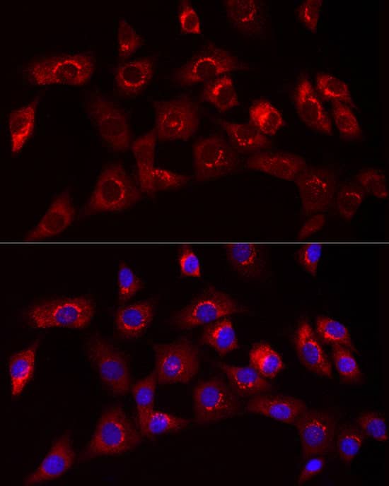 Immunocytochemistry/ Immunofluorescence: Collagen I alpha 1 Antibody - Azide and BSA Free [NBP2-92858] - Immunofluorescence analysis of NIH/3T3 cells using Collagen I alpha 1 Rabbit pAb  at dilution of 1:50 (40x lens). Secondary antibody: Cy3-conjugated Goat anti-Rabbit IgG (H+L)  at 1:500 dilution. Blue: DAPI for nuclear staining.