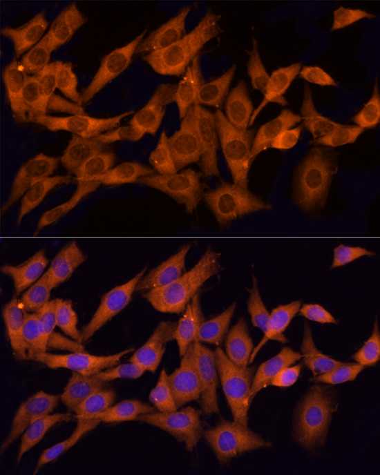 Immunocytochemistry/ Immunofluorescence CLIC1 Antibody - BSA Free