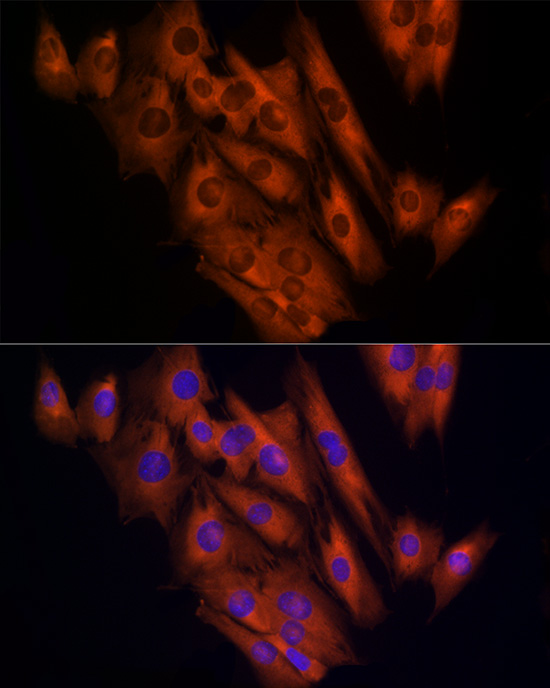 Immunocytochemistry/ Immunofluorescence CLIC1 Antibody - BSA Free