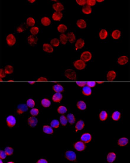 Immunocytochemistry/ Immunofluorescence: CYP11B2 Antibody - BSA Free [NBP2-92862] - Immunofluorescence analysis of HeLa cells using CYP11B2 Rabbit pAb  at dilution of 1:100 (40x lens). Secondary antibody: Cy3 Goat Anti-Rabbit IgG (H+L)  at 1:500 dilution. Blue: DAPI for nuclear staining.