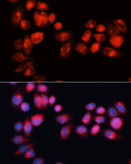 Immunocytochemistry/ Immunofluorescence: ABCB7 Antibody - Azide and BSA Free [NBP2-92864] - Immunofluorescence analysis of HeLa cells using ABCB7 Rabbit pAb  at dilution of 1:100 (40x lens). Secondary antibody: Cy3 Goat Anti-Rabbit IgG (H+L)  at 1:500 dilution. Blue: DAPI for nuclear staining.