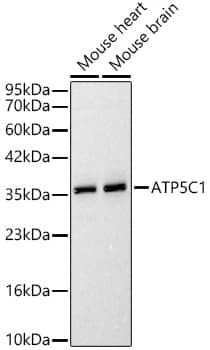 Western Blot: ATPG Antibody - Azide and BSA Free [NBP2-92867] - Western blot analysis of various lysates, using ATPG Rabbit pAb  at 1:1000 dilution.Secondary antibody: HRP-conjugated Goat anti-Rabbit IgG (H+L)  at 1:10000 dilution.Lysates/proteins: 25ug per lane.Blocking buffer: 3% nonfat dry milk in TBST.Detection: ECL Basic Kit.Exposure time: 90s.