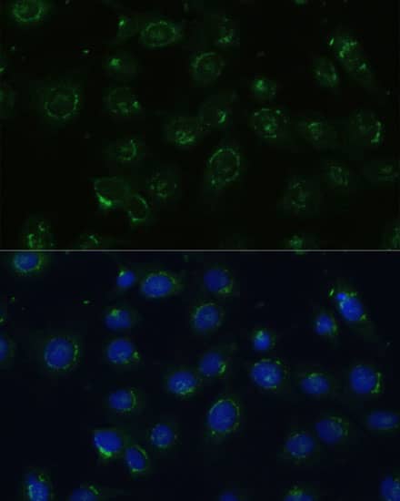 Immunocytochemistry/ Immunofluorescence: COPG2 Antibody - Azide and BSA Free [NBP2-92868] - Immunofluorescence analysis of C6 cells using COPG2 Rabbit pAb  at dilution of 1:100 (40x lens). Secondary antibody: Cy3 Goat Anti-Rabbit IgG (H+L)  at 1:500 dilution. Blue: DAPI for nuclear staining.