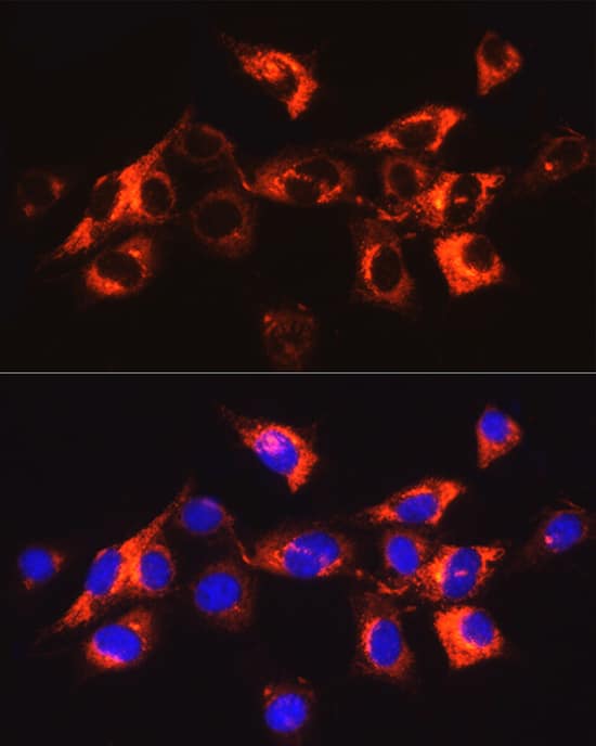 Immunocytochemistry/ Immunofluorescence: Collagen I alpha 1 Antibody - Azide and BSA Free [NBP2-92877] - Immunofluorescence analysis of NIH/3T3 cells using Collagen I alpha 1 Rabbit pAb  at dilution of 1:200 (40x lens). Secondary antibody: Cy3-conjugated Goat anti-Rabbit IgG (H+L)  at 1:500 dilution. Blue: DAPI for nuclear staining.