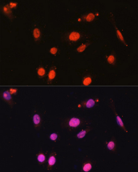 Immunocytochemistry/ Immunofluorescence: DDX17 Antibody - Azide and BSA Free [NBP2-92878] - Immunofluorescence analysis of U2OS cells using DDX17 Rabbit pAb  at dilution of 1:100. Secondary antibody: Cy3 Goat Anti-Rabbit IgG (H+L)  at 1:500 dilution. Blue: DAPI for nuclear staining.