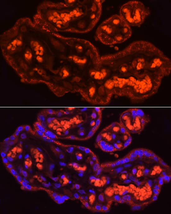 Immunocytochemistry/ Immunofluorescence: CYP11A1 Antibody - Azide and BSA Free [NBP2-92879] - Immunofluorescence analysis of paraffin-embedded human placenta using CYP11A1 Rabbit pAb  at dilution of 1:100 (40x lens). Secondary antibody: Cy3-conjugated Goat anti-Rabbit IgG (H+L)  at 1:500 dilution. Blue: DAPI for nuclear staining.