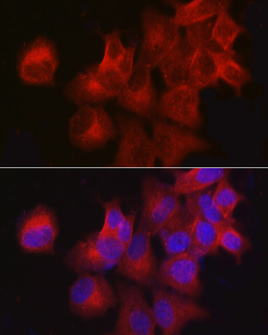 Immunocytochemistry/ Immunofluorescence: CDKN3 Antibody - Azide and BSA Free [NBP2-92881] - Immunofluorescence analysis of MCF7 cells using CDKN3 Rabbit pAb  at dilution of 1:100 (40x lens). Secondary antibody: Cy3 Goat Anti-Rabbit IgG (H+L)  at 1:500 dilution. Blue: DAPI for nuclear staining.