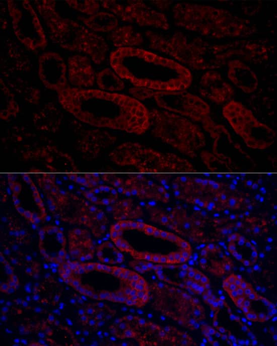 Immunocytochemistry/ Immunofluorescence: Aquaporin-3 Antibody - Azide and BSA Free [NBP2-92885] - Immunofluorescence analysis of paraffin-embedded human kidney using Aquaporin-3 Rabbit pAb  at dilution of 1:100 (40x lens). Secondary antibody: Cy3-conjugated Goat anti-Rabbit IgG (H+L)  at 1:500 dilution. Blue: DAPI for nuclear staining.