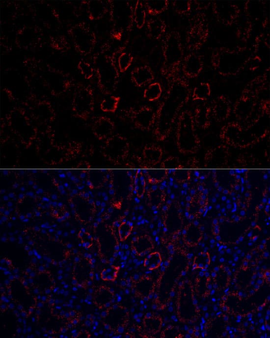 Immunocytochemistry/ Immunofluorescence: Aquaporin-3 Antibody - Azide and BSA Free [NBP2-92885] - Immunofluorescence analysis of paraffin-embedded rat kidney using Aquaporin-3 Rabbit pAb  at dilution of 1:100 (40x lens). Secondary antibody: Cy3-conjugated Goat anti-Rabbit IgG (H+L)  at 1:500 dilution. Blue: DAPI for nuclear staining.