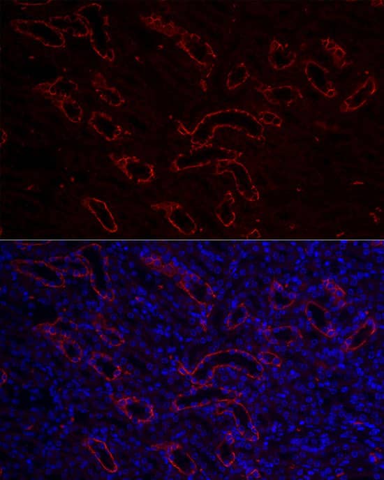 Immunocytochemistry/ Immunofluorescence: Aquaporin-3 Antibody - Azide and BSA Free [NBP2-92885] - Immunofluorescence analysis of paraffin-embedded mouse kidney using Aquaporin-3 Rabbit pAb  at dilution of 1:100 (40x lens). Secondary antibody: Cy3-conjugated Goat anti-Rabbit IgG (H+L)  at 1:500 dilution. Blue: DAPI for nuclear staining.