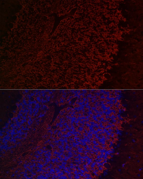 Immunocytochemistry/ Immunofluorescence: Aquaporin-4 Antibody - Azide and BSA Free [NBP2-92886] - Immunofluorescence analysis of paraffin-embedded mouse brain using Aquaporin-4 Rabbit pAb  at dilution of 1:50 (40x lens). Secondary antibody: Cy3-conjugated Goat anti-Rabbit IgG (H+L)  at 1:500 dilution. Blue: DAPI for nuclear staining.