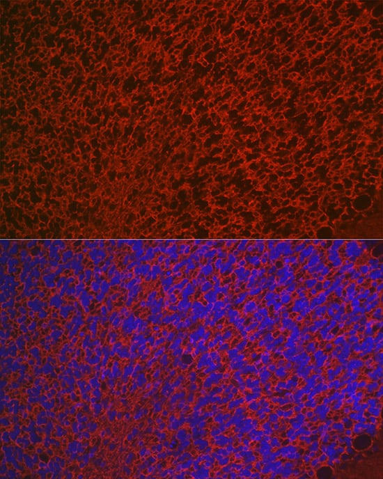Immunocytochemistry/ Immunofluorescence: Aquaporin-4 Antibody - Azide and BSA Free [NBP2-92886] - Immunofluorescence analysis of paraffin-embedded rat brain using Aquaporin-4 Rabbit pAb  at dilution of 1:50 (40x lens). Secondary antibody: Cy3-conjugated Goat anti-Rabbit IgG (H+L)  at 1:500 dilution. Blue: DAPI for nuclear staining.