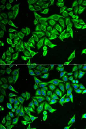 Immunocytochemistry/ Immunofluorescence DAP1 Antibody - BSA Free