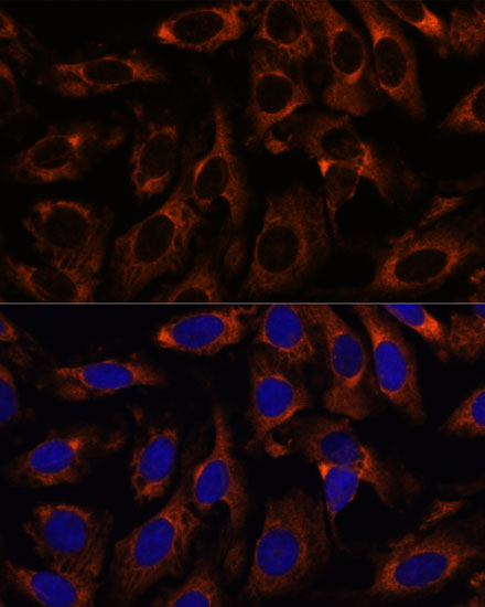 Immunocytochemistry/ Immunofluorescence: CCT3 Antibody - BSA Free [NBP2-92903] - Immunofluorescence analysis of U-2 OS cells using CCT3 antibody  at dilution of 1:100. Blue: DAPI for nuclear staining.