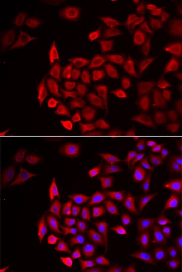 Immunocytochemistry/ Immunofluorescence: Cochlin Antibody - BSA Free [NBP2-92904] - Immunofluorescence analysis of HeLa cells using Cochlin Rabbit pAb . Secondary antibody: Cy3 Goat Anti-Rabbit IgG (H+L)  at 1:500 dilution. Blue: DAPI for nuclear staining.