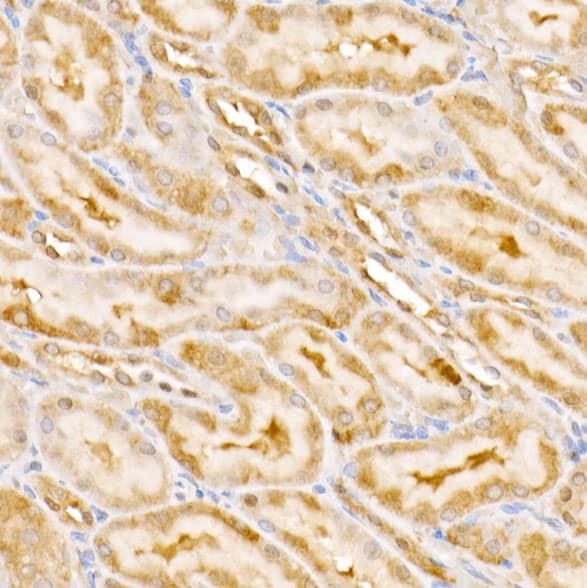 Immunohistochemistry: CSN1 Antibody - BSA Free [NBP2-92907] - Immunohistochemistry analysis of paraffin-embedded Rat kidney using CSN1 Rabbit pAb  at dilution of 1:200 (40x lens). Perform high pressure antigen retrieval with 10 mM citrate buffer pH 6.0 before commencing with IHC staining protocol.