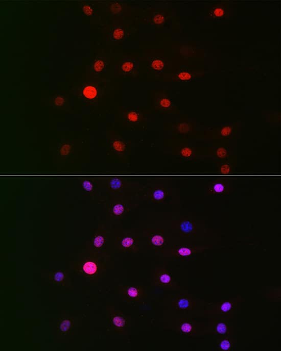 Immunocytochemistry/ Immunofluorescence: CSN1 Antibody - BSA Free [NBP2-92907] - Immunofluorescence analysis of NIH/3T3 cells using CSN1 Rabbit pAb  at dilution of 1:100 (40x lens). Secondary antibody: Cy3 Goat Anti-Rabbit IgG (H+L)  at 1:500 dilution. Blue: DAPI for nuclear staining.