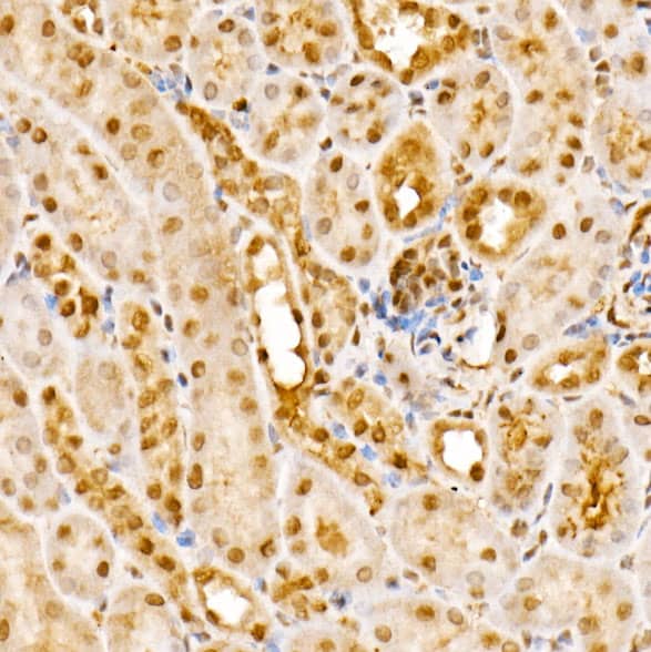 Immunohistochemistry: CSN1 Antibody - BSA Free [NBP2-92907] - Immunohistochemistry analysis of paraffin-embedded Mouse kidney using CSN1 Rabbit pAb  at dilution of 1:200 (40x lens). Perform high pressure antigen retrieval with 10 mM citrate buffer pH 6.0 before commencing with IHC staining protocol.