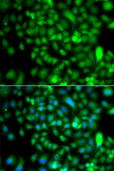 Immunocytochemistry/ Immunofluorescence CSRP2BP Antibody - BSA Free