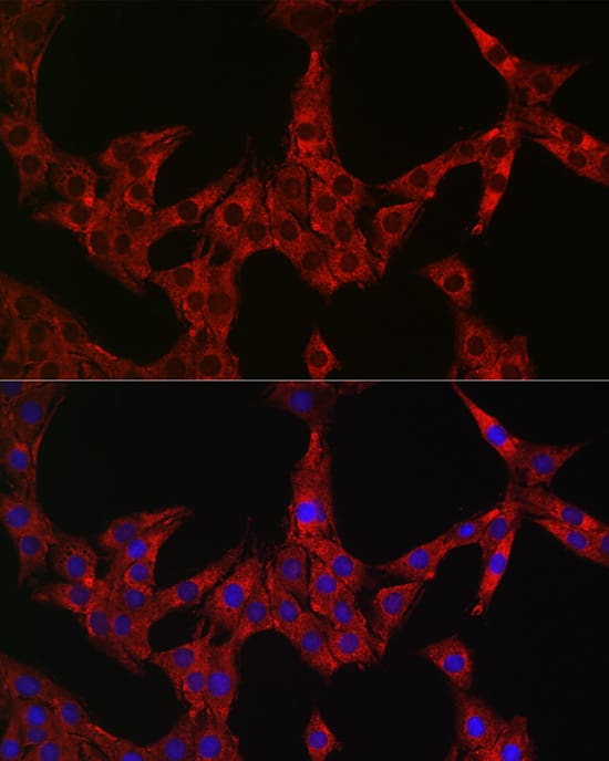 Immunocytochemistry/ Immunofluorescence: Dfna5 Antibody - Azide and BSA Free [NBP2-92914] - Immunofluorescence analysis of PC-12 cells using GSDME Rabbit pAb  at dilution of 1:50. Secondary antibody: Cy3-conjugated Goat anti-Rabbit IgG (H+L)  at 1:500 dilution. Blue: DAPI for nuclear staining.