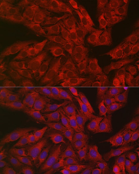 Immunocytochemistry/ Immunofluorescence: Dfna5 Antibody - Azide and BSA Free [NBP2-92914] - Immunofluorescence analysis of U2OS cells using GSDME Rabbit pAb  at dilution of 1:50. Secondary antibody: Cy3-conjugated Goat anti-Rabbit IgG (H+L)  at 1:500 dilution. Blue: DAPI for nuclear staining.