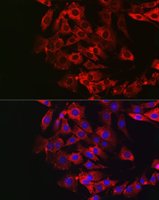 Immunocytochemistry/ Immunofluorescence: Dfna5 Antibody - Azide and BSA Free [NBP2-92914] - Immunofluorescence analysis of NIH/3T3 cells using GSDME Rabbit pAb  at dilution of 1:50. Secondary antibody: Cy3-conjugated Goat anti-Rabbit IgG (H+L)  at 1:500 dilution. Blue: DAPI for nuclear staining.