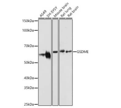 Western Blot: Dfna5 Antibody [NBP2-92914] -Analysis of various lysates using GSDME Rabbit pAb at 1:1000 dilution incubated overnight at 4℃.Secondary antibody: HRP-conjugated Goat anti-Rabbit IgG (H+L) at 1:10000 dilution.Lysates/proteins: 25 μg per lane.Blocking buffer: 3% nonfat dry milk in TBST.Detection: ECL Basic Kit. Exposure time: 90s.