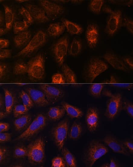 Immunocytochemistry/ Immunofluorescence: CAD Antibody - BSA Free [NBP2-92924] - Immunofluorescence analysis of U-2 OS cells using CAD Rabbit pAb  at dilution of 1:100. Secondary antibody: Cy3 Goat Anti-Rabbit IgG (H+L)  at 1:500 dilution. Blue: DAPI for nuclear staining.