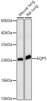 Western Blot: Aquaporin-5 Antibody - Azide and BSA Free [NBP2-92926] - Western blot analysis of various lysates, using Aquaporin-5 Rabbit pAb  at 1:2000 dilution.Secondary antibody: HRP-conjugated Goat anti-Rabbit IgG (H+L)  at 1:10000 dilution.Lysates/proteins: 25ug per lane.Blocking buffer: 3% nonfat dry milk in TBST.Detection: ECL Basic Kit.Exposure time: 60s.