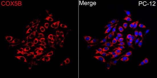 Immunocytochemistry/ Immunofluorescence COX5b Antibody - BSA Free