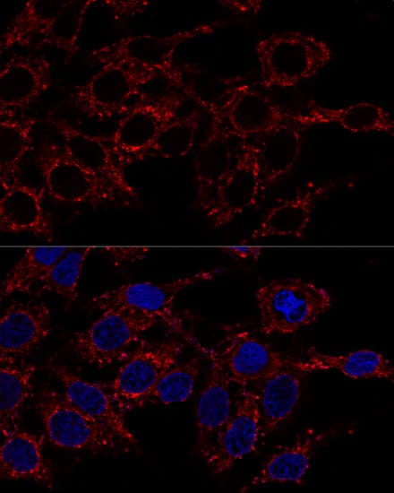 Immunocytochemistry/ Immunofluorescence: ATP5A Antibody - BSA Free [NBP2-92928] - Confocal immunofluorescence analysis of Hela cells using ATP5A Rabbit pAb  at dilution of 1:200. Blue: DAPI for nuclear staining.
