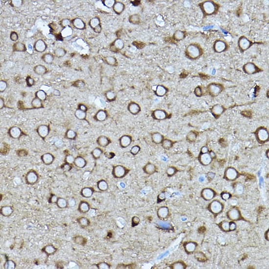 Immunohistochemistry: Rabbit Polyclonal CRMP2 Antibody [NBP2-92939] - Immunohistochemistry analysis of paraffin-embedded rat brain using [KO Validated] CRMP2/CRMP2/DPYSL2 Rabbit pAb at dilution of 1:400 (40x lens).Perform high pressure antigen retrieval with 10 mM citrate buffer pH 6.0 before commencing with IHC staining protocol.